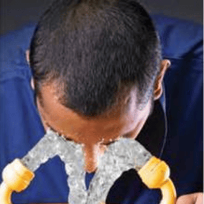 Giải pháp sơ cấp cứu văng bắn hóa chất - Thiết bị rửa mắt tắm khẩn cấp